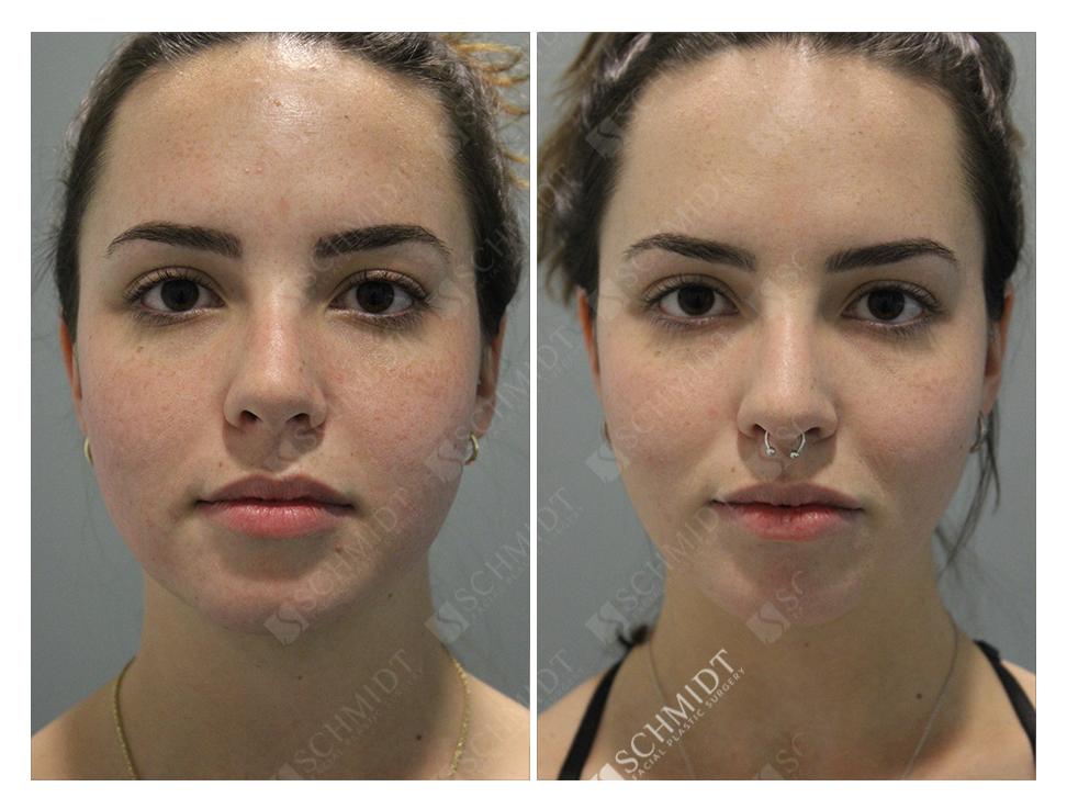 6570 Schmidt Facial Plastic Surgery 7006